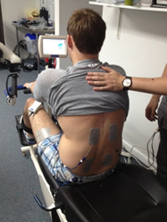  Проведение процедуры у пациента со спинальной травмой (нижний парапарез). 